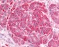 INSR / Insulin Receptor Antibody (Internal)